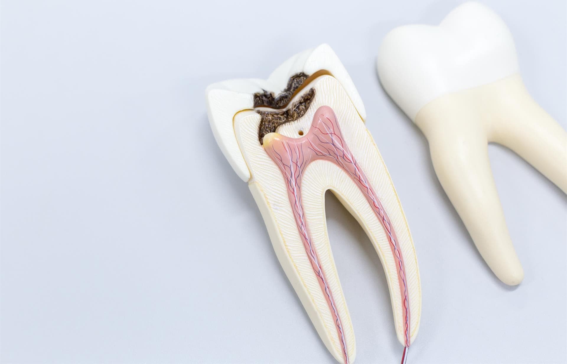 Ventajas de la odontología restauradora o conservadora