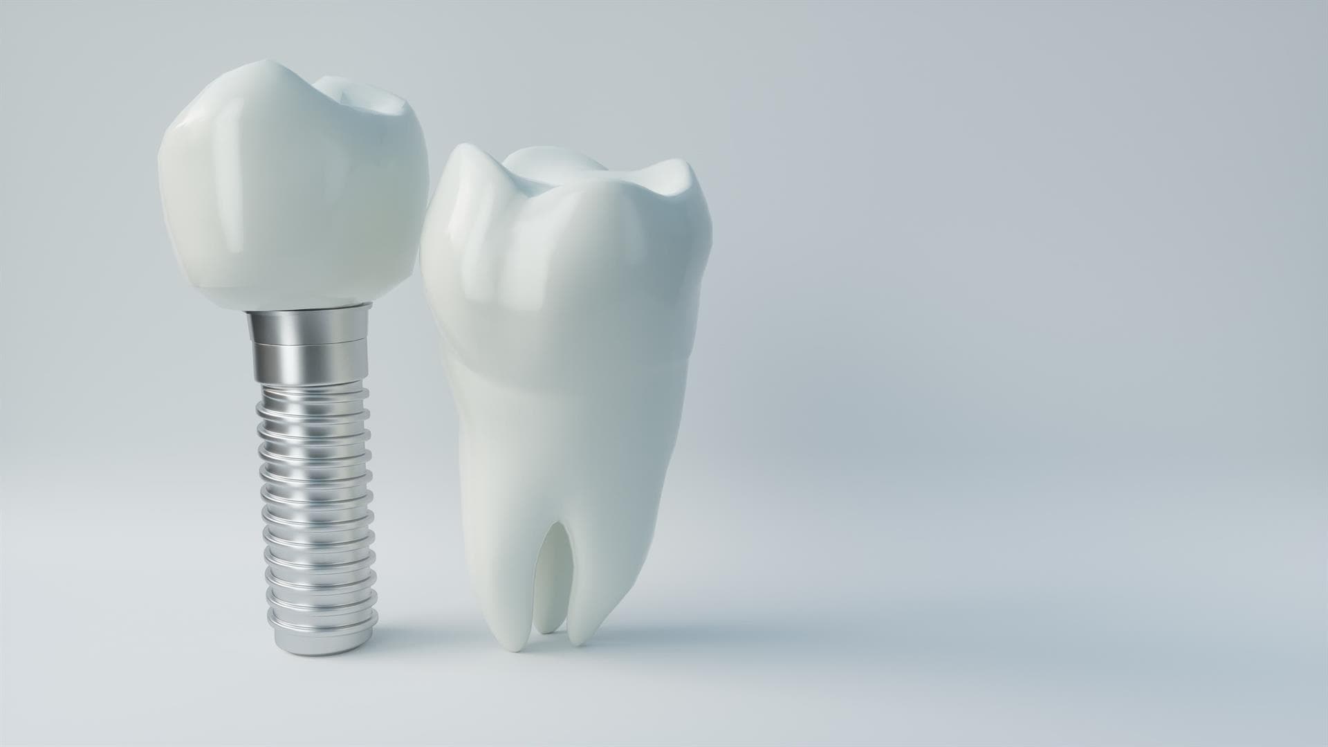 Implantes dentales en Arteixo
