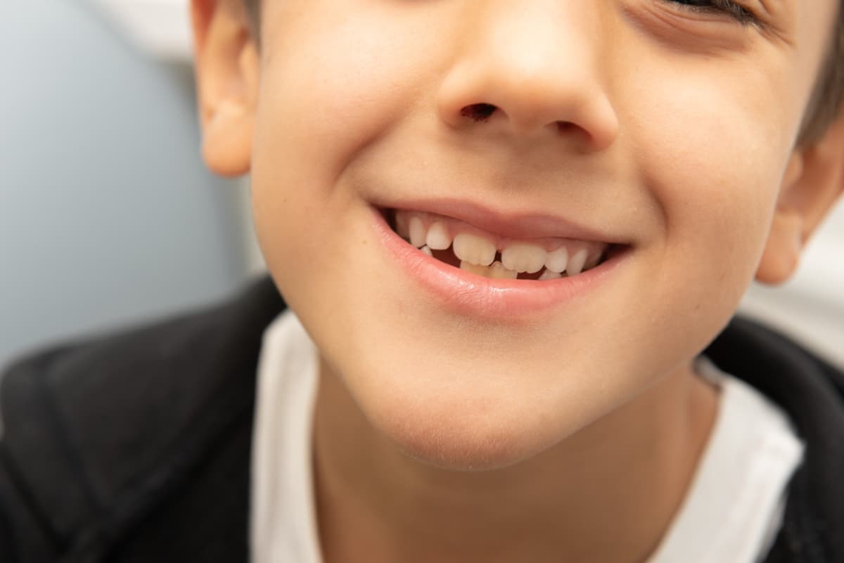 Tratamientos de ortodoncia en niños