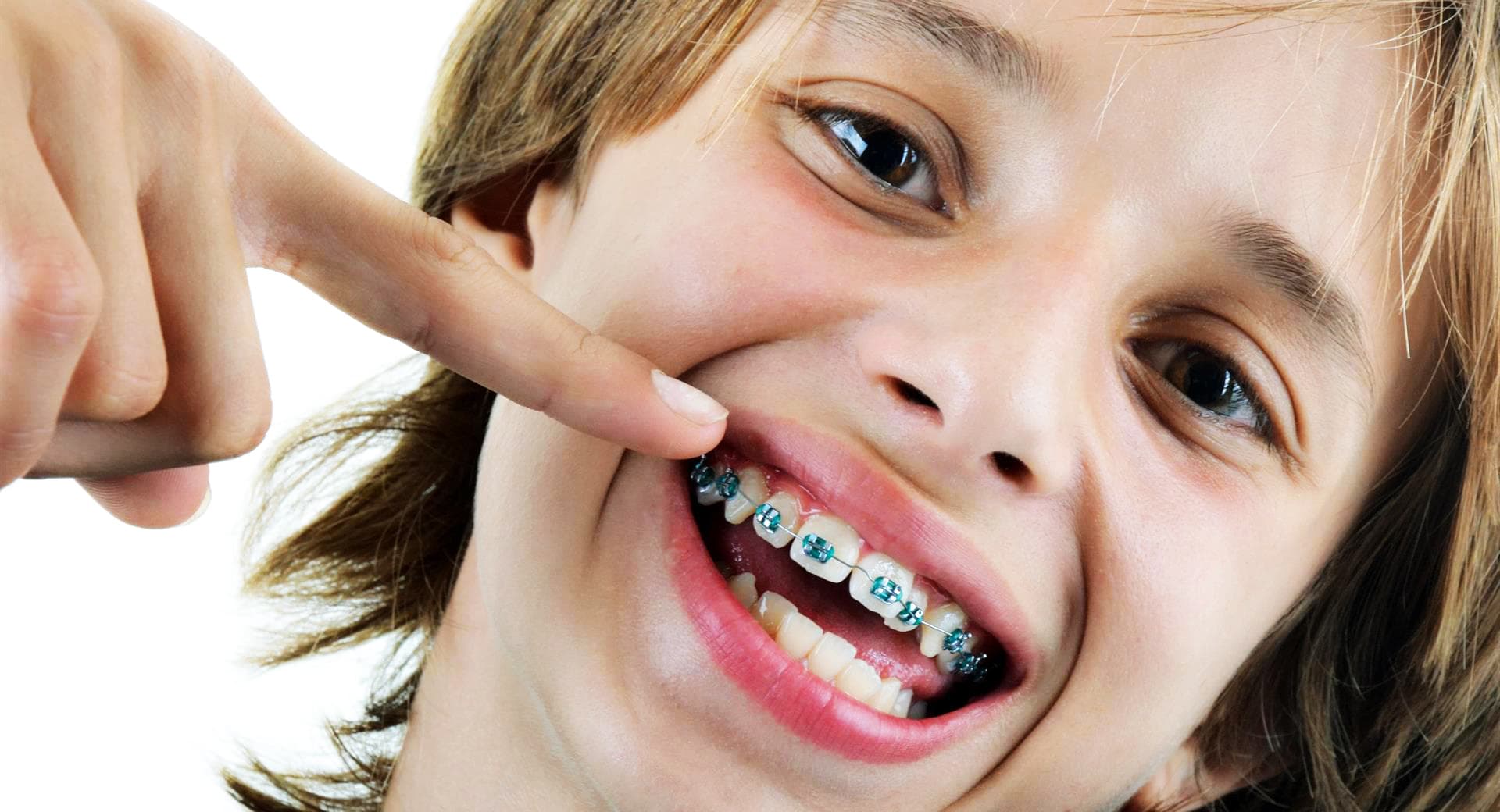  Brackets metálicos en Arteixo