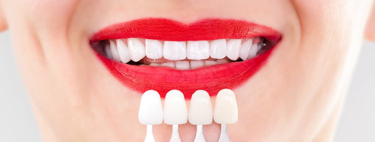 Estética dental en Arteixo