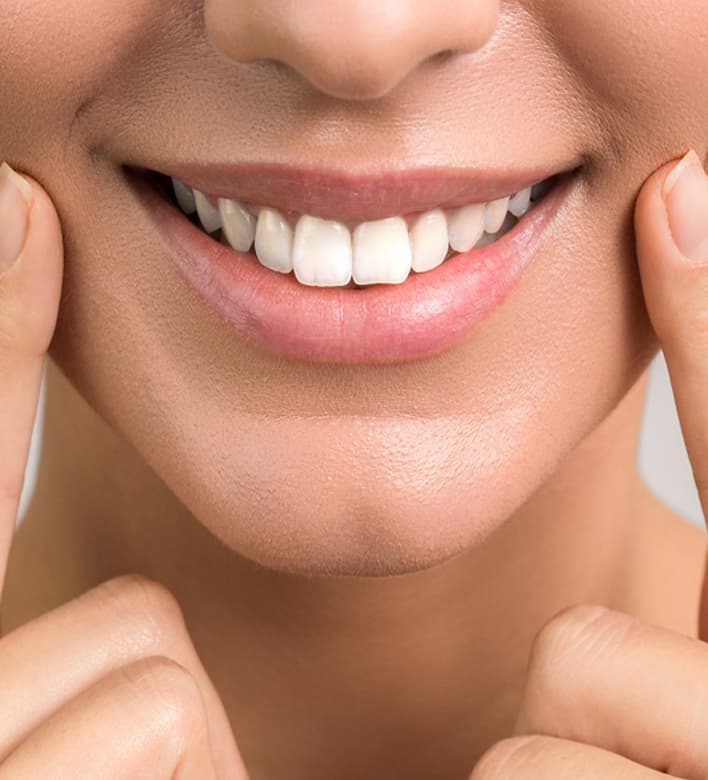 Luce la sonrisa que siempre quisiste